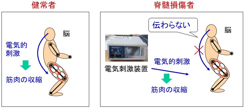 電気刺激による遠隔リハビリテーション 石川高専 河合研究室